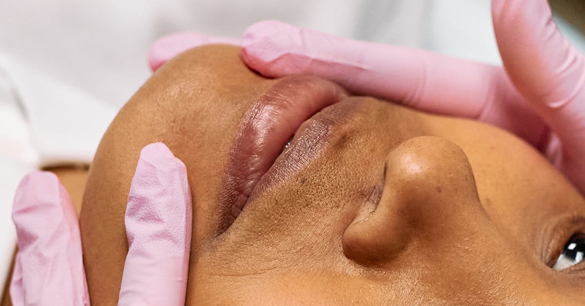 Managing Side Effects of Chemical Peels: Tips and Tricks