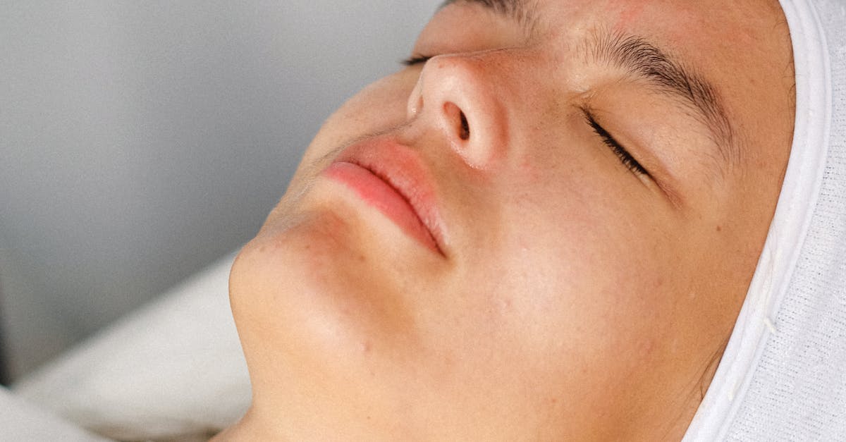 The Benefits of Facial Acupuncture in Medical Spa Treatments